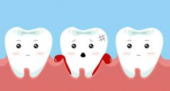 膜龈手术在牙龈乳头保留与重建中的应用