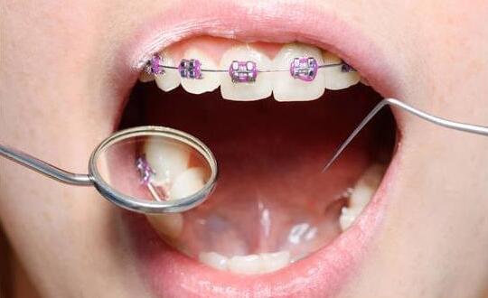 西安人如何预防孩子牙齿