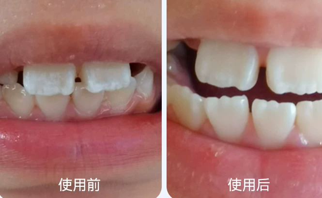 实测不踩雷，适合中国儿童的防蛀牙膏怎么选？看懂这几个关键指标